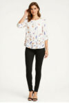 213193-HUESO-1